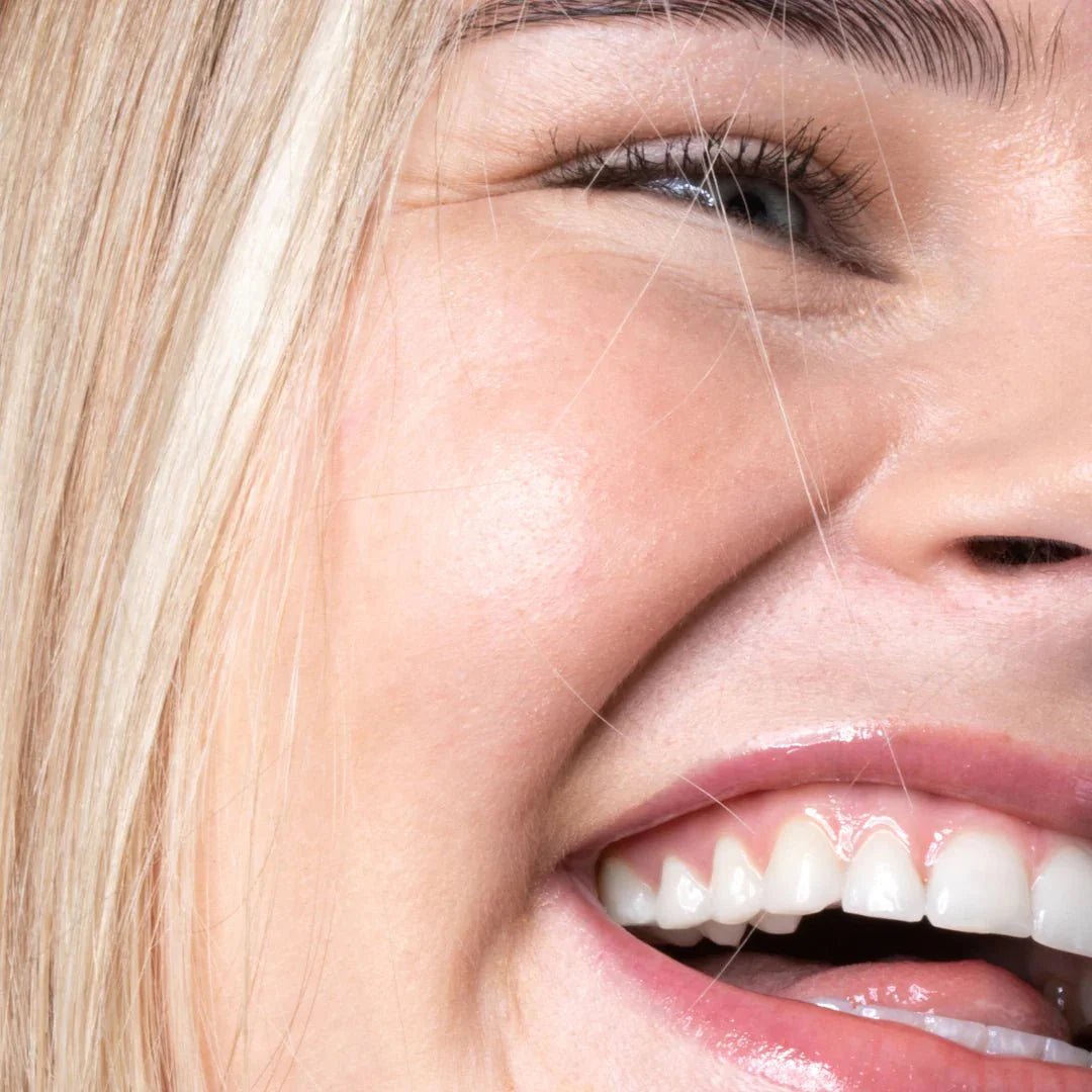 Bělení zubů - LYSS.cz