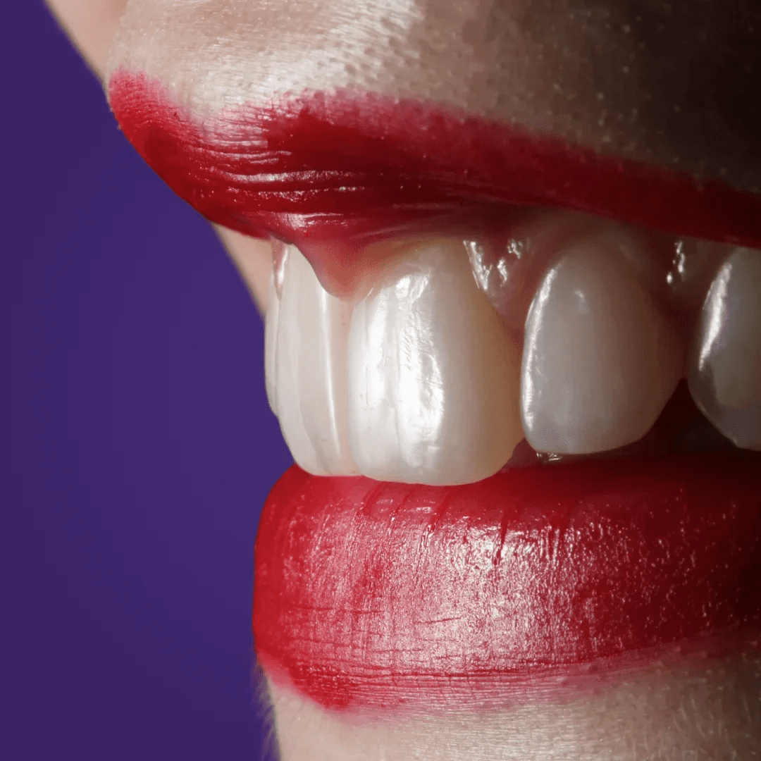 Odhalené zubní krčky – co s tím a jak jim předejít? - LYSS.cz