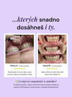 LYSS Oil Pulling - kokosový olej na zuby - LYSS.cz
