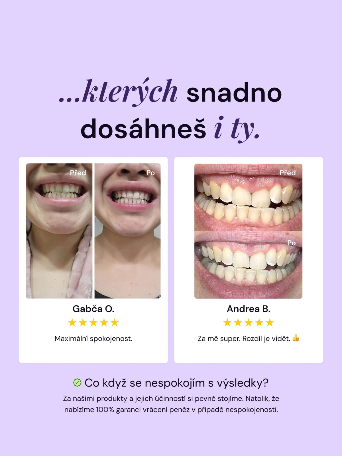 V34 bělicí korektor na zuby - LYSS.cz