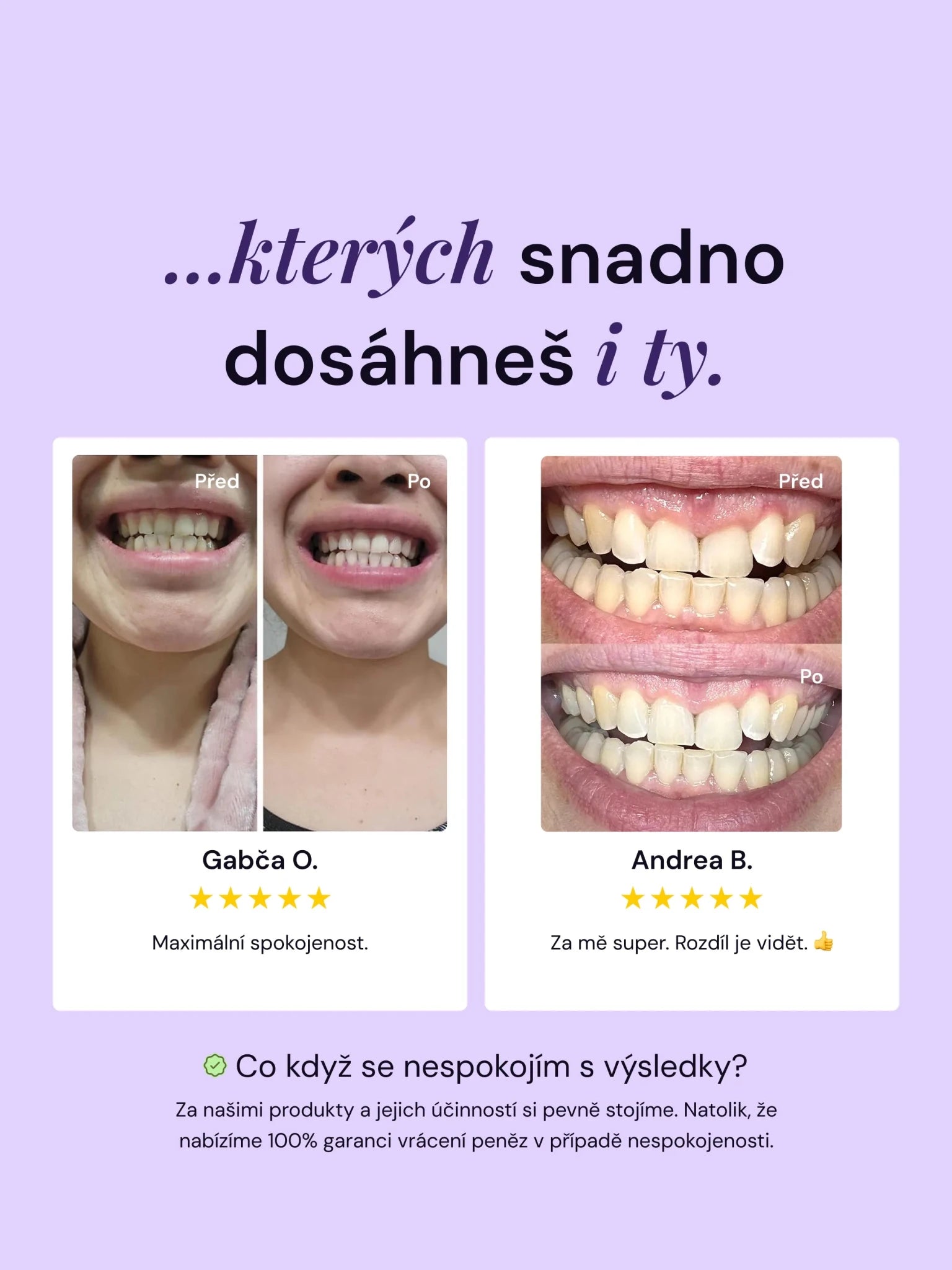 V34 bělicí korektor na zuby - LYSS.cz