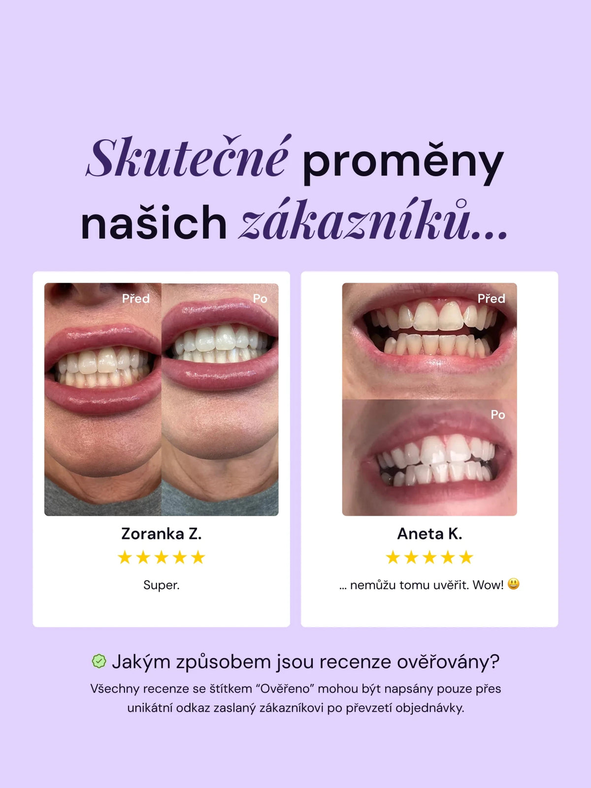 Výhodný balíček - V34 bělicí pásky + zubní pasta LYSS - LYSS.cz