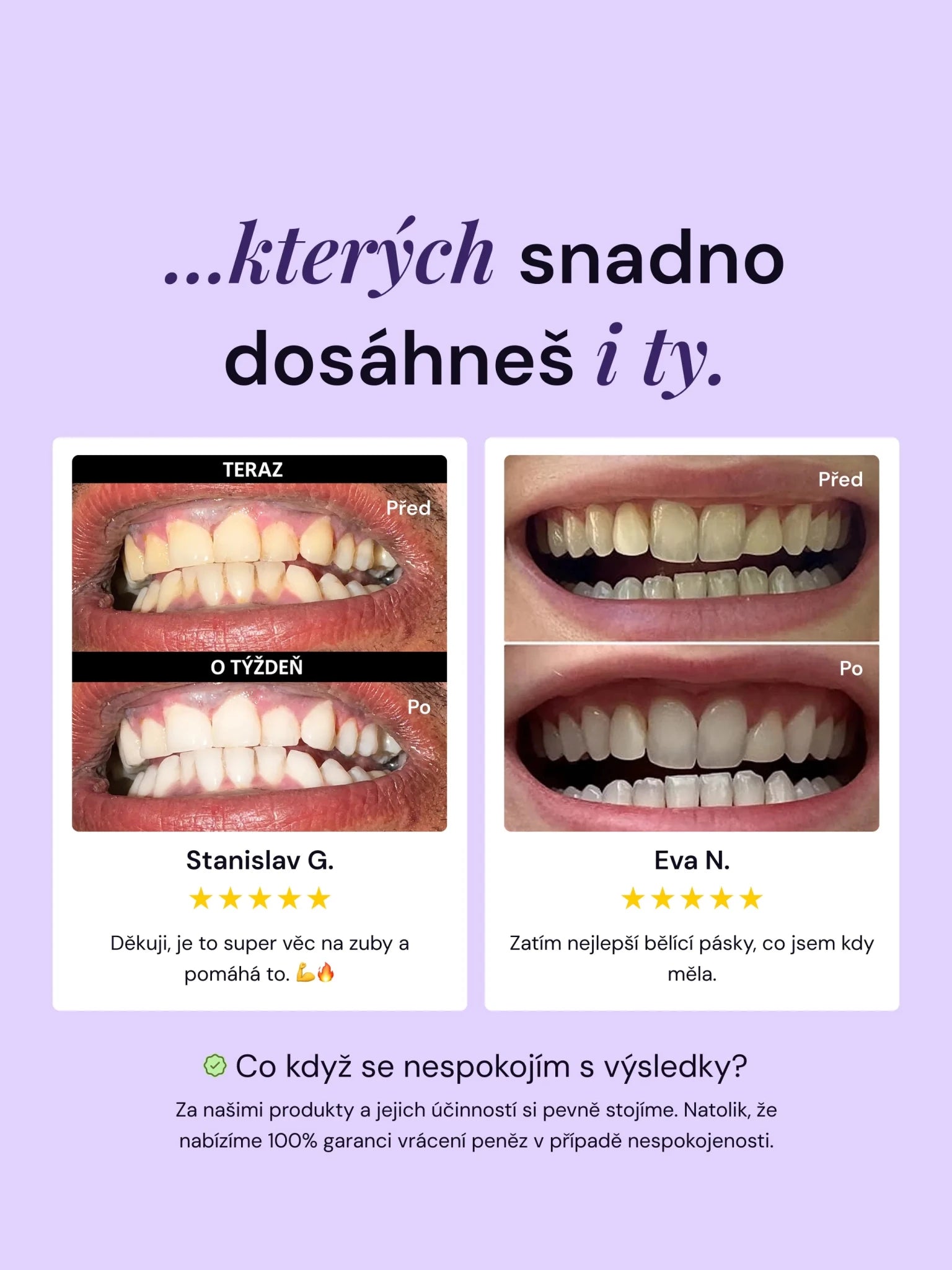 Výhodný balíček - V34 bělicí pásky + zubní pasta LYSS - LYSS.cz